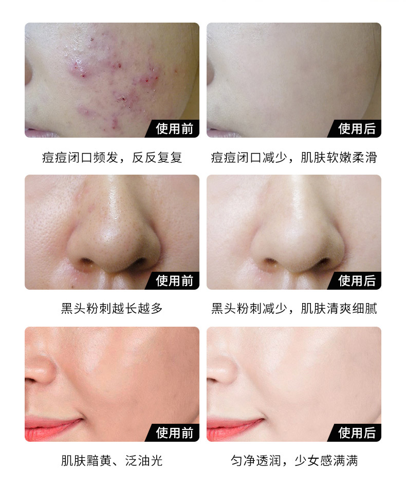 歐泉生化 歐泉生化