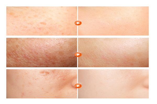 極致美白祛斑霜讓你擺脫“素顏煩惱”-歐泉生化 極致美白祛斑霜讓你擺脫“素顏煩惱”-歐泉生化