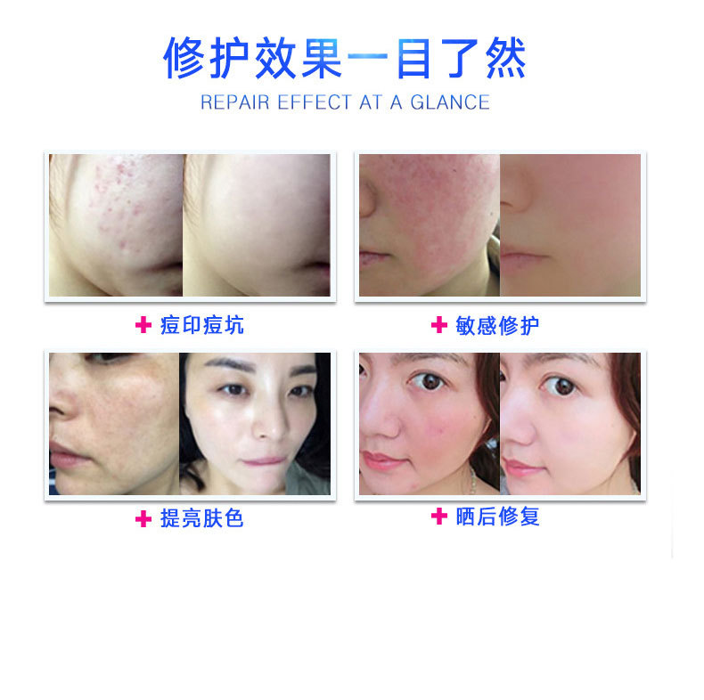 凍干粉-歐泉生化 凍干粉-歐泉生化