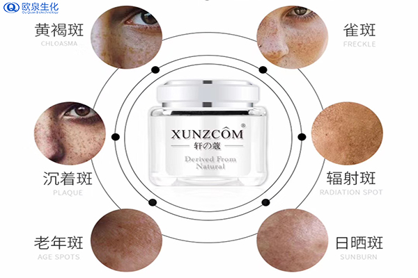 捉!黃黑斑日常護膚指南來了-歐泉生化 捉!黃黑斑日常護膚指南來了-歐泉生化