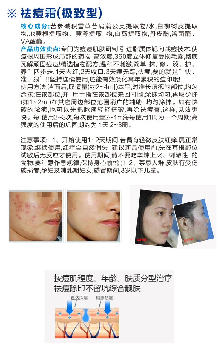 控油平衡凈痘霜-歐泉生化 控油平衡凈痘霜-歐泉生化