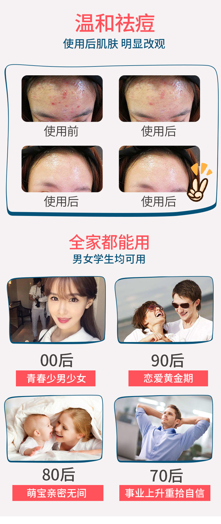 控油平衡凈痘霜-歐泉生化 控油平衡凈痘霜-歐泉生化