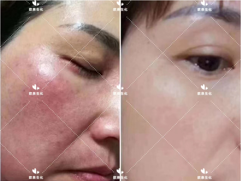 生長因子-歐泉生化 生長因子-歐泉生化